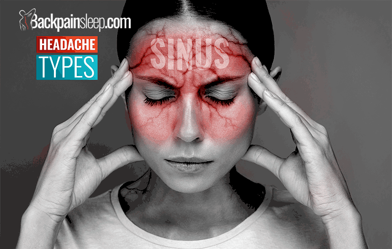 Tension Headaches Symptoms