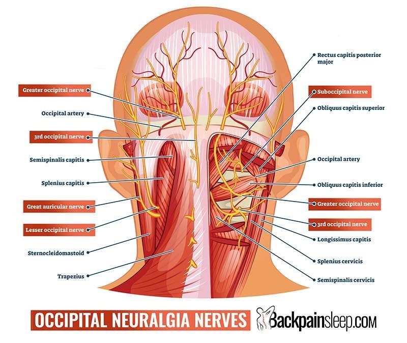 Diagram showing occipital neuralgia nerve pathways at the base of the skull