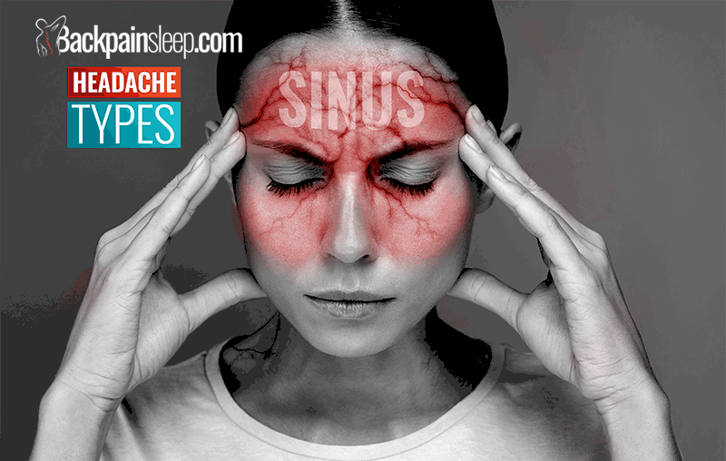 Visual guide to common headache types and locations